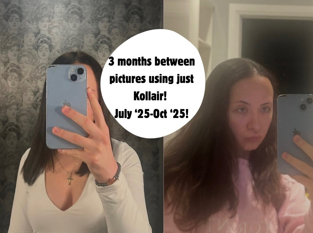 High Potency Follicle Recovery Oil